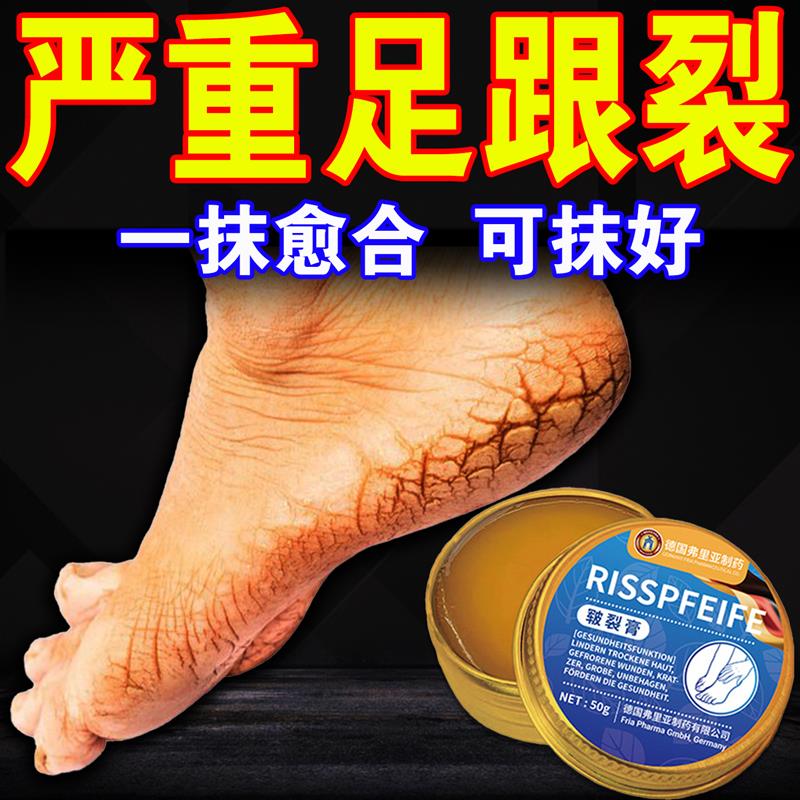 德国脚后跟干裂修覆霜手足龟裂开裂皲裂治起皮去死皮润马油皱裂膏