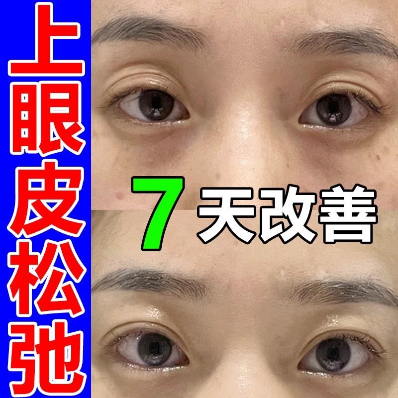 眼皮下垂提拉眼膜上眼皮松弛提拉紧致三眼皮大小眼矫正贴专用神器