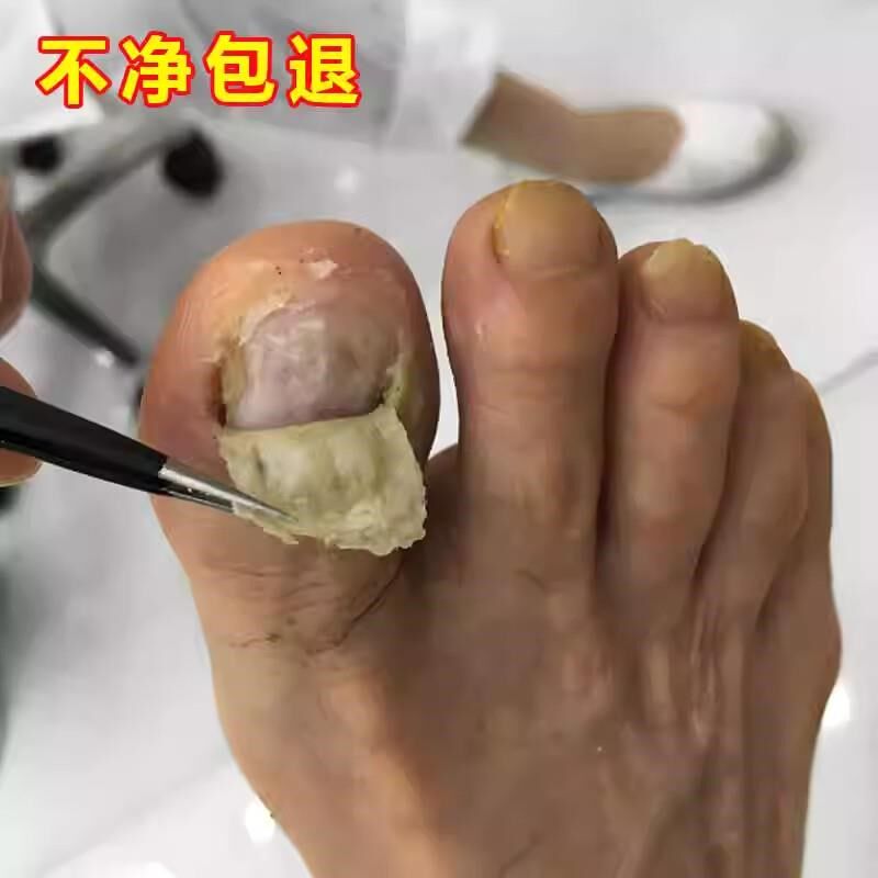 滴一滴 抑菌不脱甲 祛除坏 钾 买2送1 !!