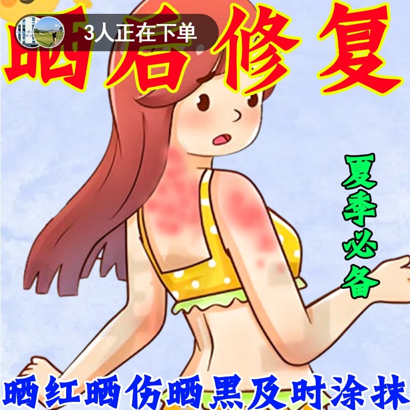 晒黑了修复快速变白防脖子手臂脸皮肤晒伤神器男女士全身专用