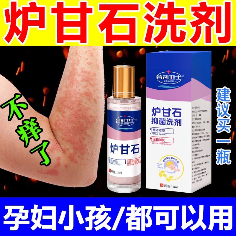 滚珠式炉甘石抑菌洗液洗剂水外用卢甘石孕妇儿童皮肤痒乳膏软膏粉