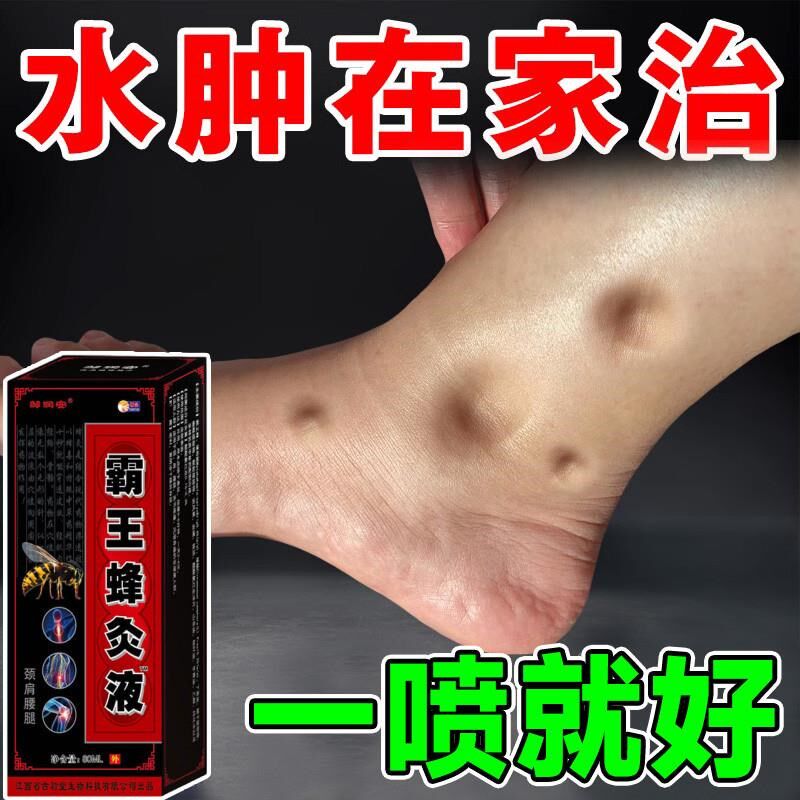 祛脚肿水肿的药小腿部浮肿胀老人脚水肿的药泡脚排肿排水神器