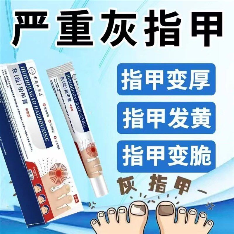 正品灰趾指甲膏凝胶无痛去灰指甲严重甲沟炎指甲增厚亮甲液抑菌膏