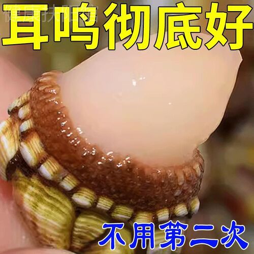 消耳鸣【快准狠】神经性耳鸣耳聋听力下降耳闷耳朵嗡响耳康神器YN