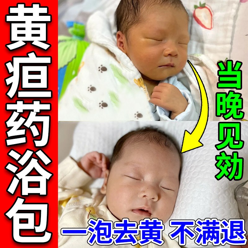 去黄疸药浴新生的儿去黄疸药浴婴儿退黄疸黄栀子去黄疸草本泡澡包