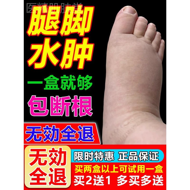 脚肿消的肿药利尿排水肿利尿剂消脸部水肿神器老人去水肿脚肿药贴