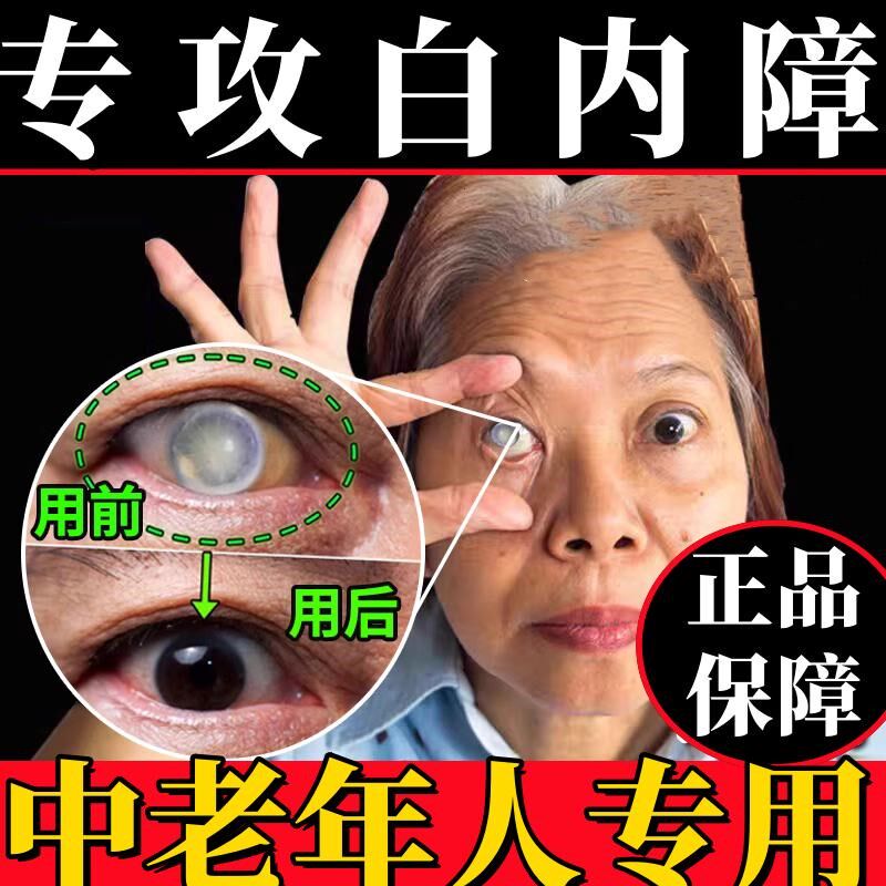 白内障专用眼药水治疗中老年人眼睛模糊晶状体浑浊治白内障滴眼液