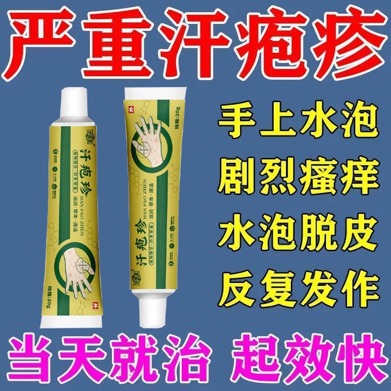 严重手痒起小水泡脱皮季节性蜕皮干裂真菌感染水泡汗疱疹止痒膏