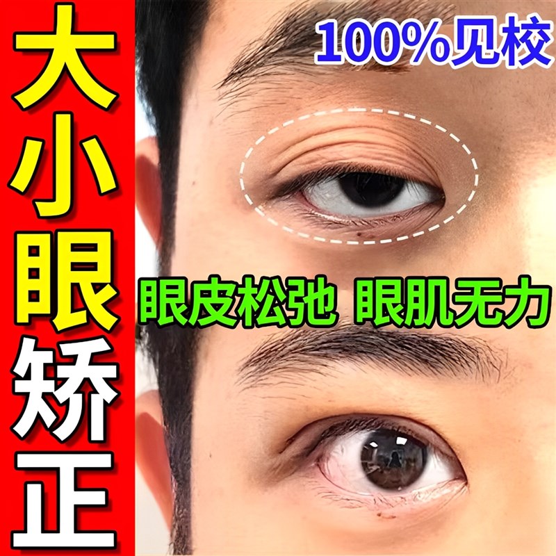 大小眼矫正器眼皮下垂提拉双眼皮无神松弛肌无力肿眼泡紧致专用贴