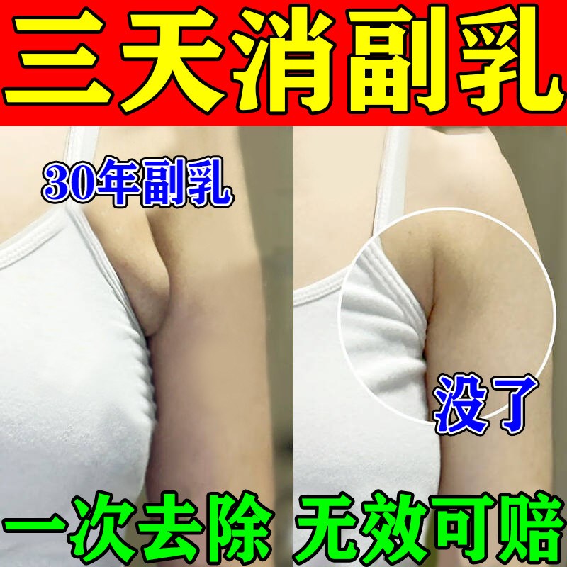 【最快三天去副乳】副乳消除贴去腋下林巴结疏通疏结膏去副乳神器