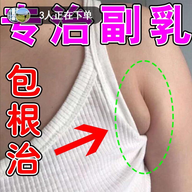 副乳脖子淋巴疏通神器治脖子颈部结节散结肿大疏通腋窝排毒消除贴