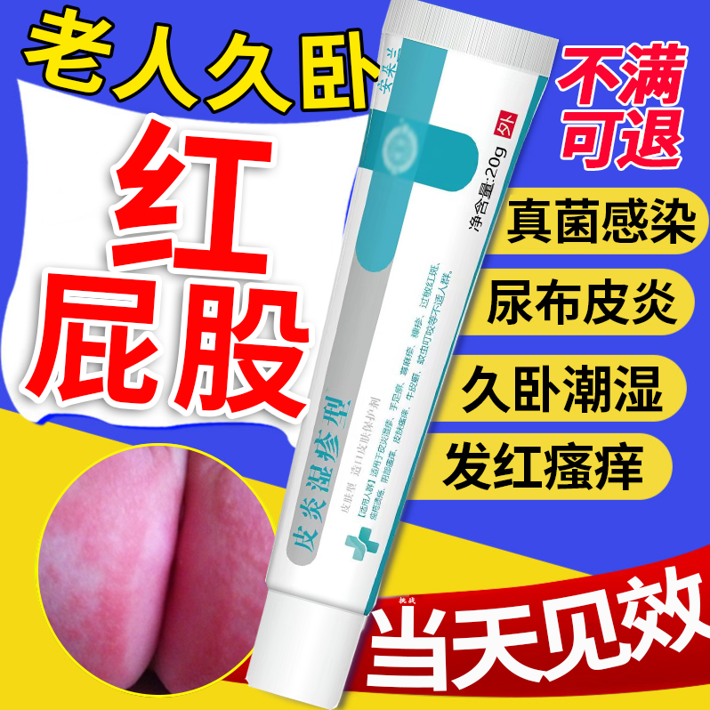 【老人久卧红屁股】专用软膏