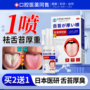 舌苔白厚口臭调理舌头裂纹有齿痕调理脾胃健口腔喷雾漱口水