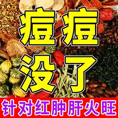 茶叶祛斑排痘痘毒内分泌调理清热凉茶熬夜花茶去内调痘美容养颜茶