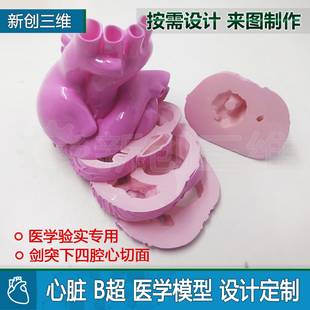 3d打印B超心脏切面模型剑突下四腔心切面左心房肾脏胃部医学定制