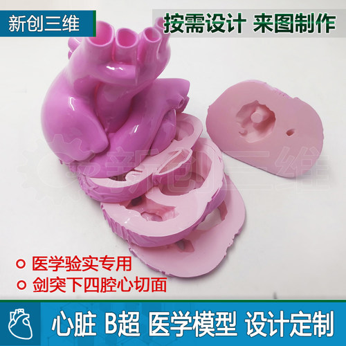 3d打印B超心脏切面模型剑突下四腔心切面左心房肾脏胃部医学定制