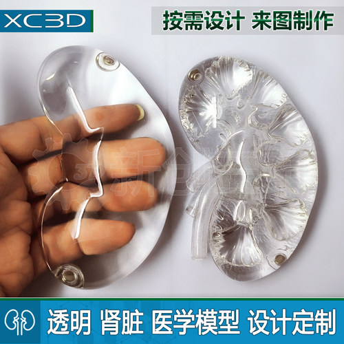 透明3D打印医疗肾脏模型医学训练