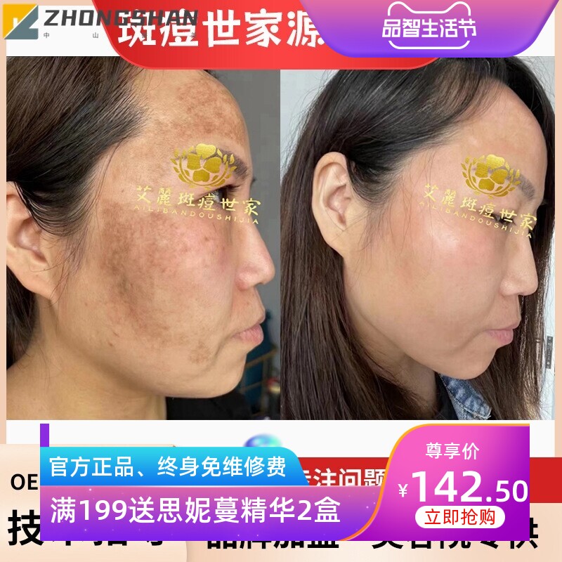 无尴尬期净斑组合美白透肤淡斑精华液祛斑霜提亮肤色黄褐斑