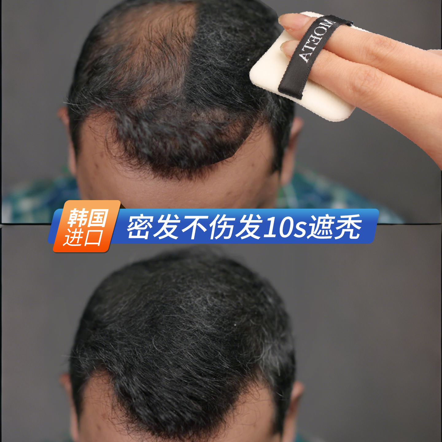 男士头发纤维粉视觉增发密发补发缝神器发际线填充喷雾稀疏遮盖