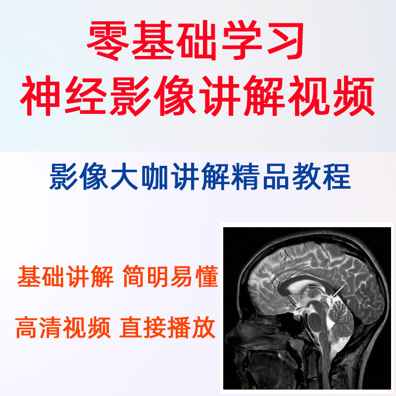 神经视频课程中枢内科诊断影像