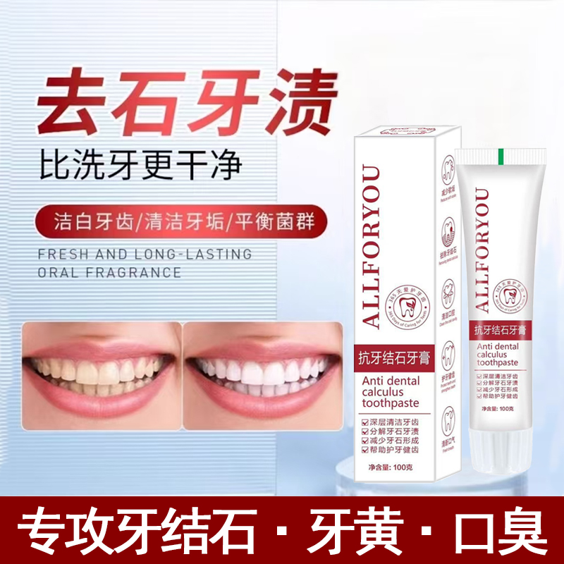 【爆款甄选】牙结石去除器美白去黄除口臭烟渍牙垢牙石溶解牙膏
