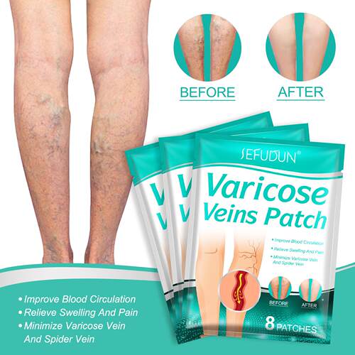 Varicose Veins Patch Spider Veins Veins Pain Relief Patch贴