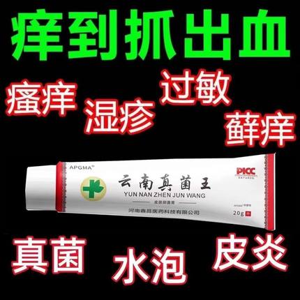 【云南止痒王】止痒正品抑菌膏快速止痒皮肤瘙痒外用全身止痒膏