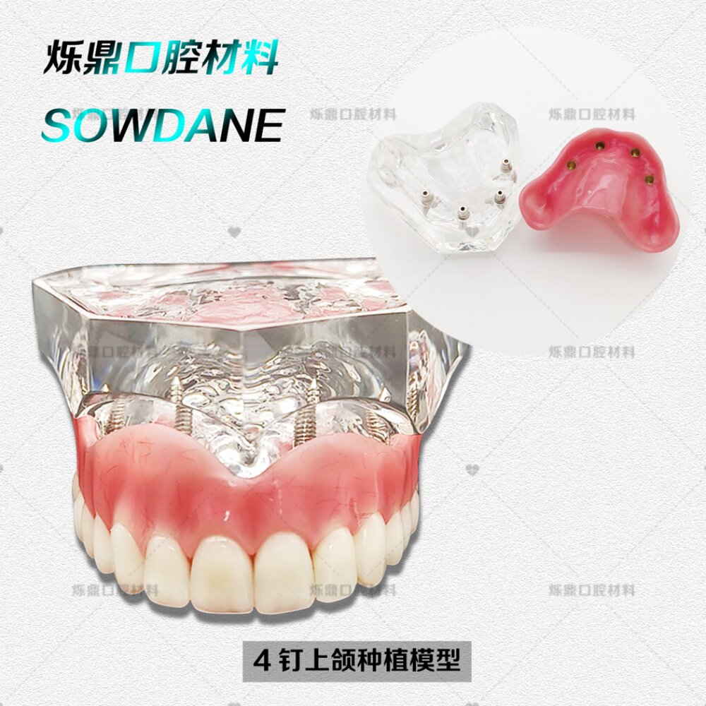 牙科口腔种植4钉上颌模型牙模齿科教学展示模型医患沟通齿科口腔
