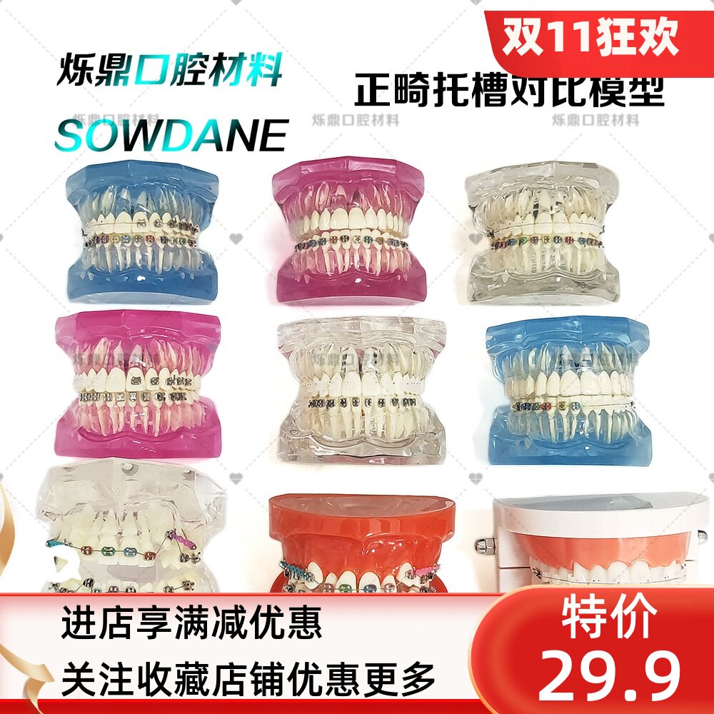牙科正畸矫正模型金属自锁陶瓷托槽金属托槽对比模型教学医患沟通