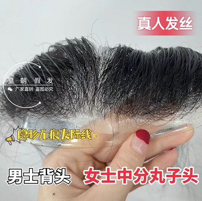 发际线贴自然隐形无痕刘海前额M型脱发补发男女通用假发生物头皮