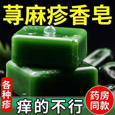 香港荨麻疹香皂过敏性慢性胆碱性止痒皮肤瘙痒提高免疫力沐浴露