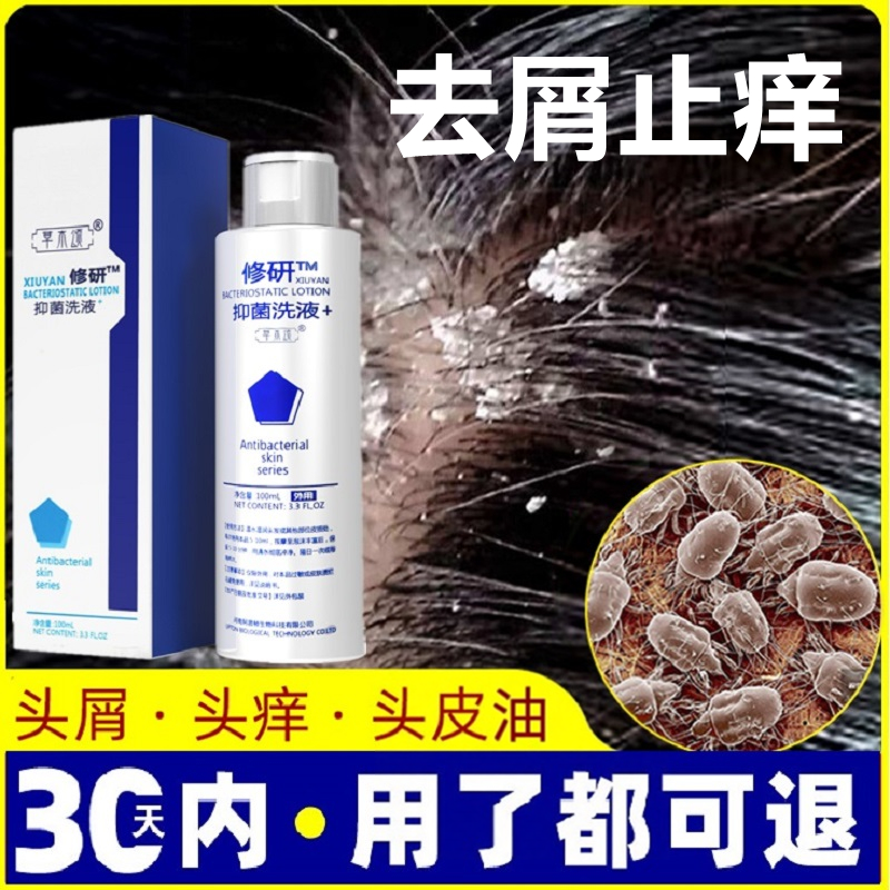 去大块头皮屑严重头痒除螨藓癣医药去屑头痒脂溢性控油正品洗发水