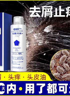 头皮屑严重去大块头屑除头螨头痒去屑止痒控油洗发水修研正品洗剂