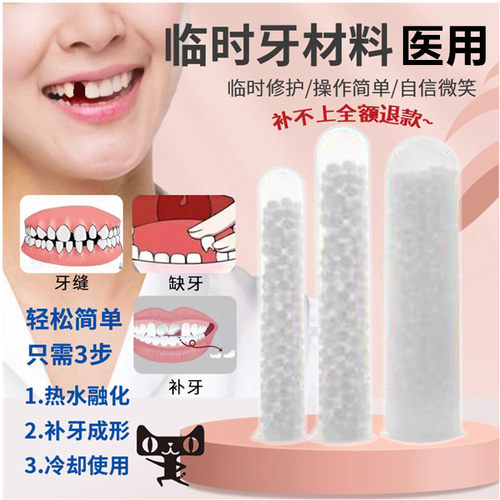 牙齿自补临时材料树脂仿真