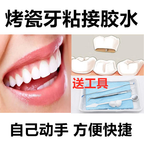 牙科烤瓷牙胶水粘接剂自己动手粘烤瓷牙胶水