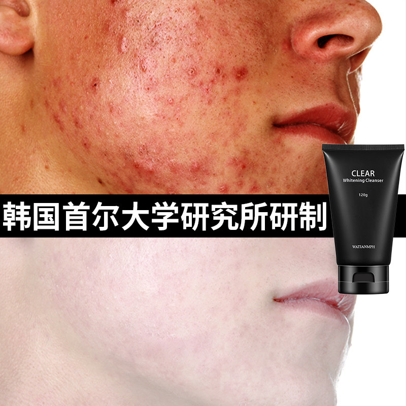 韩国洗面奶祛痘淡化痘印控油去黑头美白除螨虫男士专用学生洁面女
