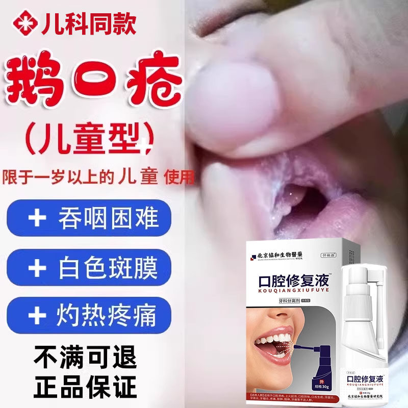 鹅口疮雪口病凝胶儿童宝宝喷剂可搭配药膏口腔黏膜修复吞咽困难tu