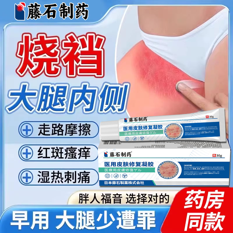 烧裆走路摩擦大腿内侧出汗刺痛