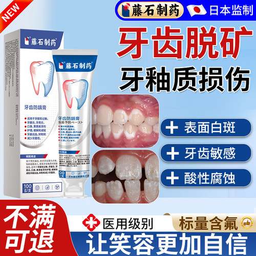 牙齿脱矿含氟不辣口-药监认证