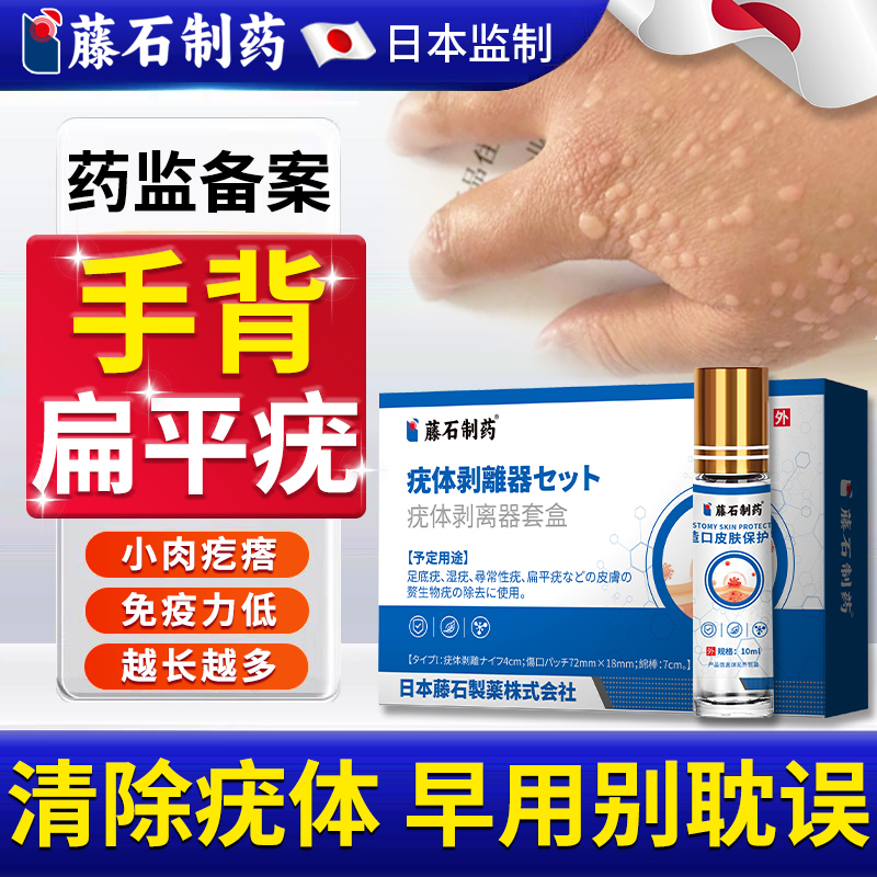 藤石制药手背扁平疣小肉疙瘩