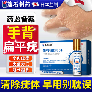 手背扁平疣去除软膏一抹灵根凝胶疣神器专用干扰素b2药房同售膏WQ