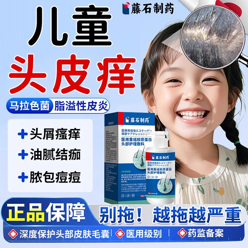 儿童头皮痒-脂溢性皮炎-医用级别