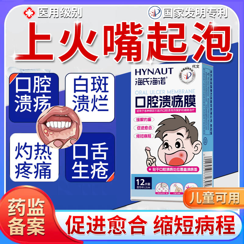 口腔上火嘴巴溃烂专用口腔溃疡贴