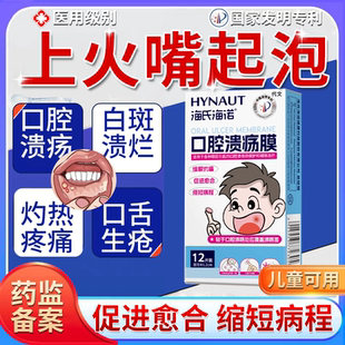 口腔上火口舌起泡嘴巴溃烂反复口腔溃疡专用膜贴儿童药房同售膏VQ