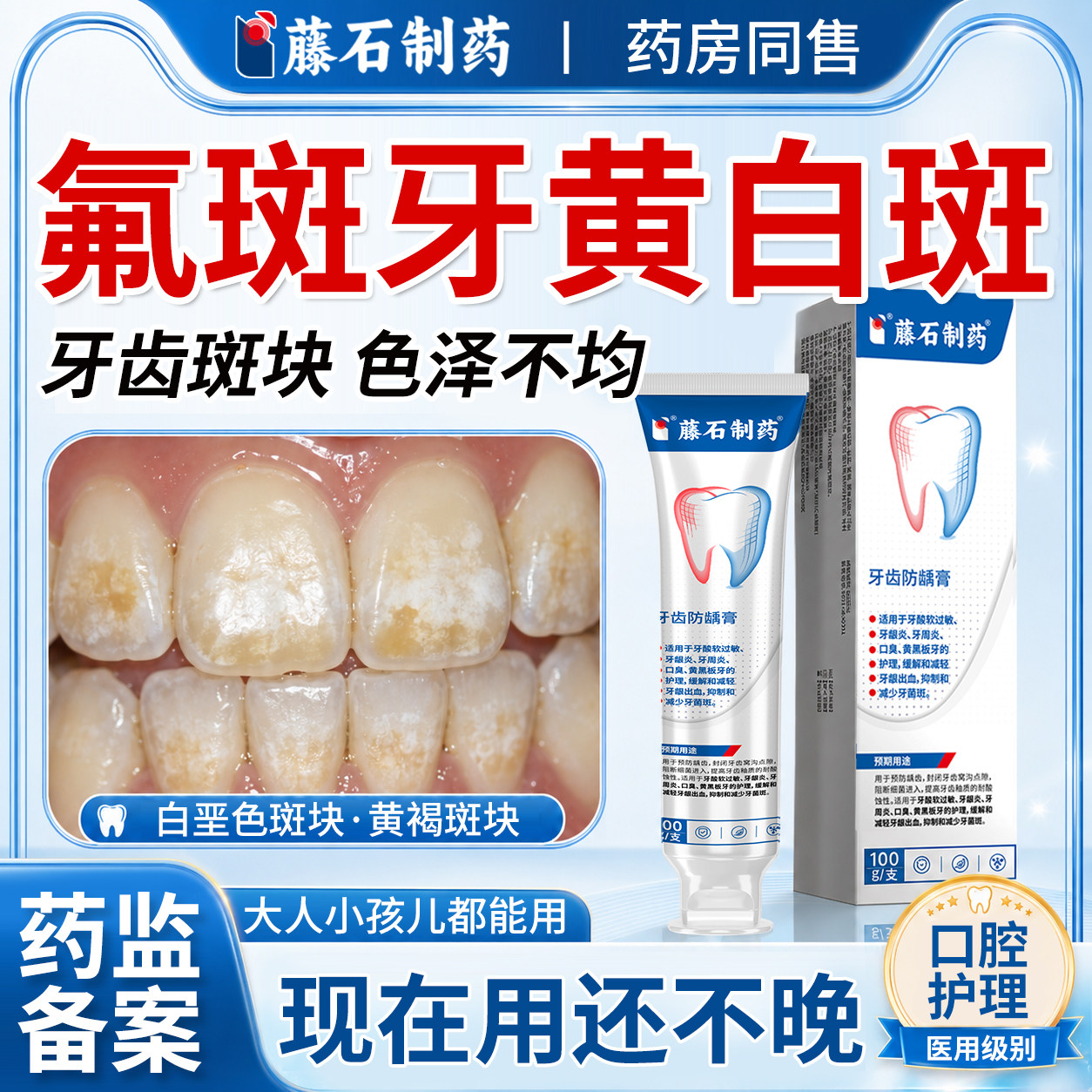 氟斑牙专用去除白斑黄褐色可搭牙膏用儿童牙齿色素沉淀牙菌斑WQ