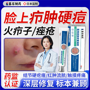 脸上疖肿结节硬块痘痘起硬疙瘩红肿毛囊炎痤疮火疖子囊肿脓包型WQ