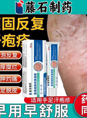 脚上汗泡疱疹去脚底起小水泡又痒又脱皮瘙痒根止痒膏药房同款膏VQ