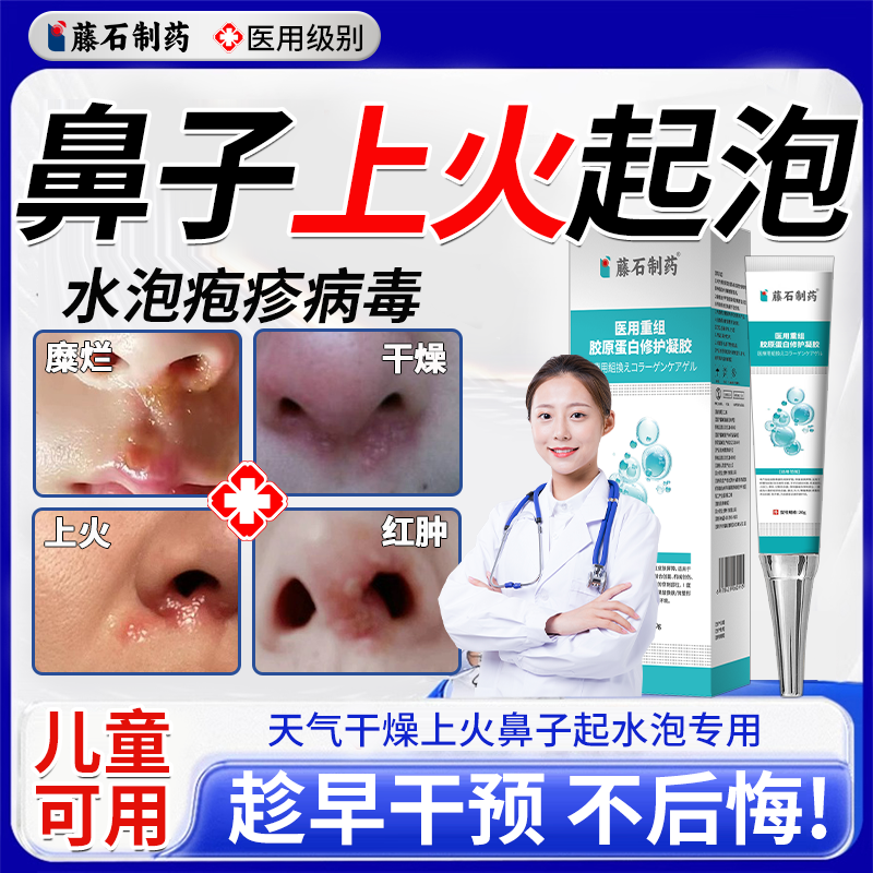 鼻子上火起泡干燥生疮子下面长痘红肿疼痛痒单纯疱疹药房同售膏VQ