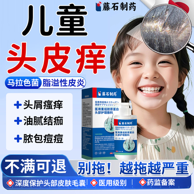 儿童头皮痒-脂溢性皮炎-医用级别