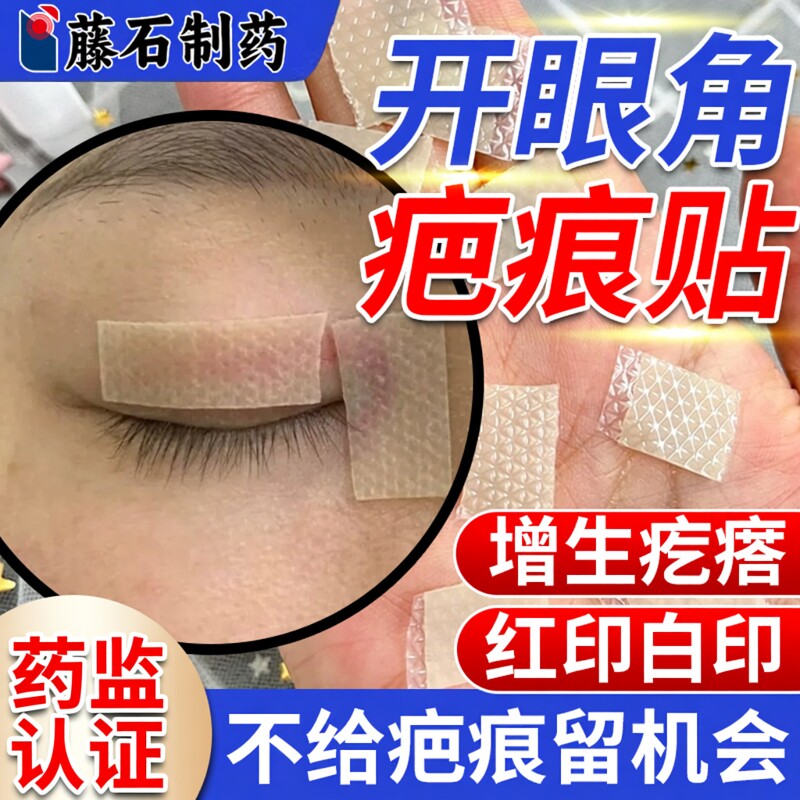 医用开眼角割双眼皮术后疤痕贴内眼角手术修复增生贴去疤祛疤贴HT
